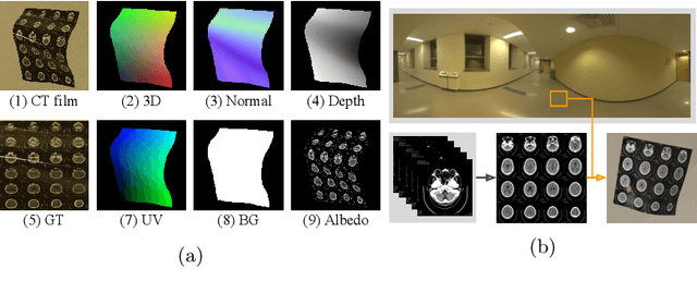 Figure 3 for Recovering medical images from CT film photos