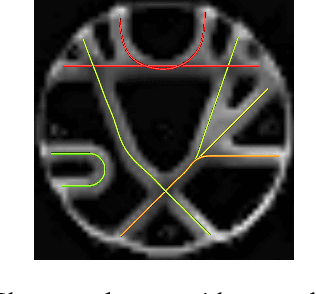 Figure 3 for Local Water Diffusion Phenomenon Clustering From High Angular Resolution Diffusion Imaging (HARDI)