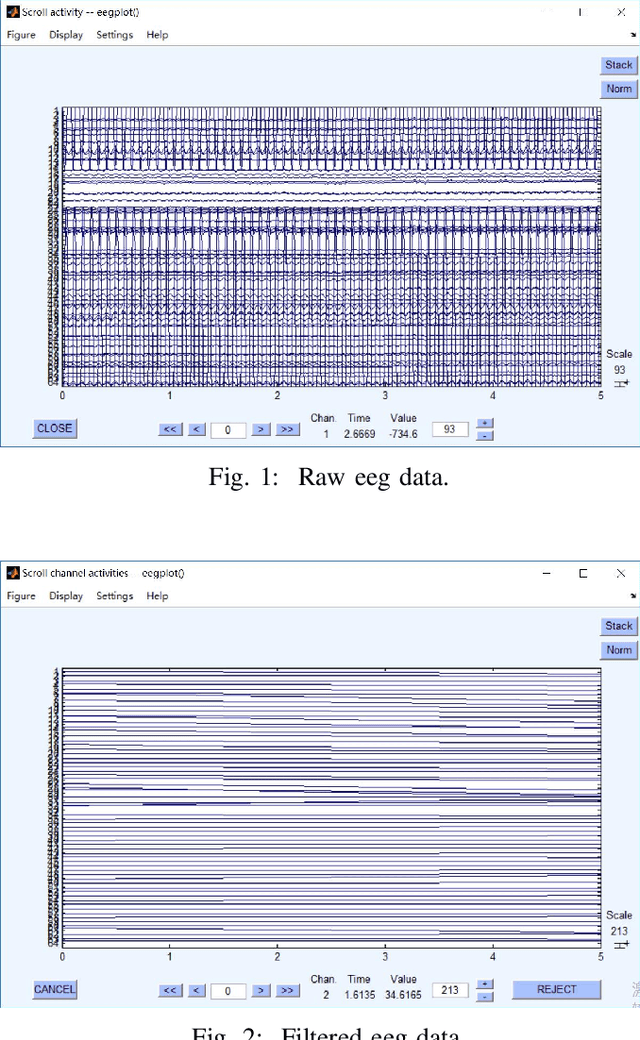 Figure 1 for Individual Recognition in Schizophrenia using Deep Learning Methods with Random Forest and Voting Classifiers: Insights from Resting State EEG Streams