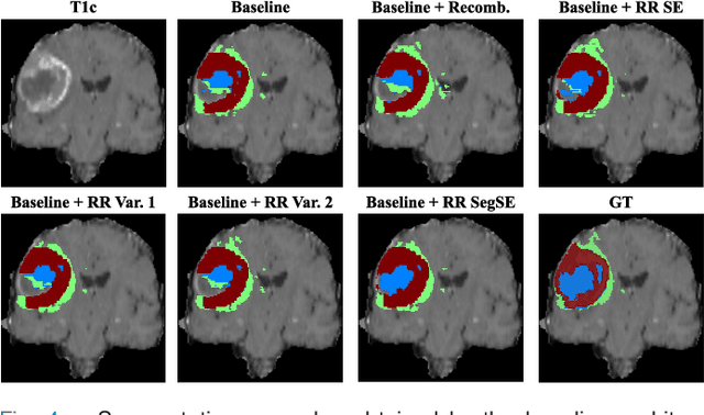 Figure 4 for Adaptive feature recombination and recalibration for semantic segmentation with Fully Convolutional Networks