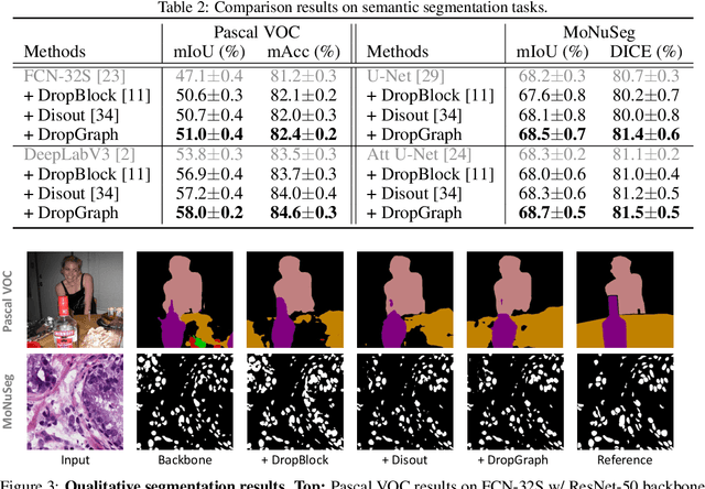 Figure 4 for Partial Graph Reasoning for Neural Network Regularization