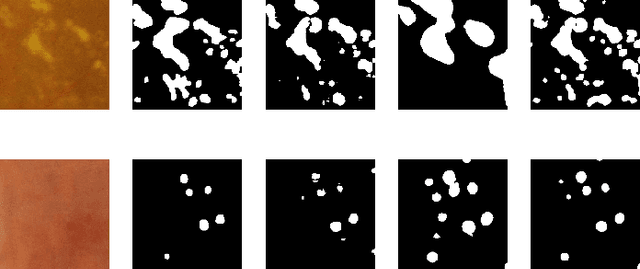 Figure 3 for Learning Mutually Local-global U-nets For High-resolution Retinal Lesion Segmentation in Fundus Images