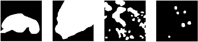 Figure 4 for Learning Mutually Local-global U-nets For High-resolution Retinal Lesion Segmentation in Fundus Images