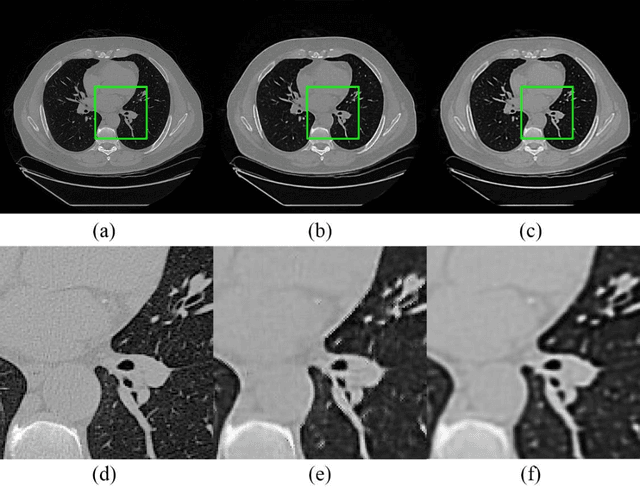 Figure 3 for Generative Models Improve Radiomics Performance in Different Tasks and Different Datasets: An Experimental Study