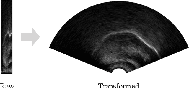 Figure 1 for Automatic audiovisual synchronisation for ultrasound tongue imaging