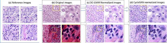 Figure 2 for Domain Adaptation-based Augmentation for Weakly Supervised Nuclei Detection