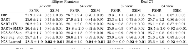 Figure 2 for Self-Supervised Training For Low Dose CT Reconstruction