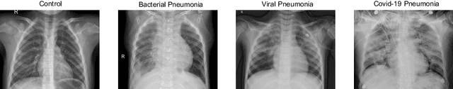 Figure 1 for Uncertainty-driven ensembles of deep architectures for multiclass classification. Application to COVID-19 diagnosis in chest X-ray images