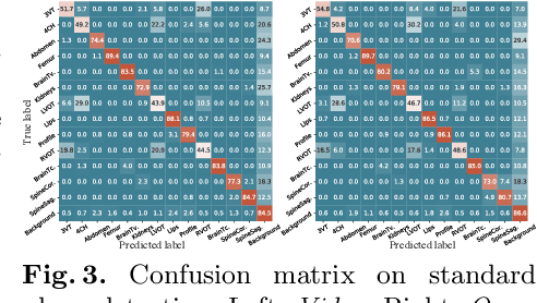 Figure 4 for Self-supervised Contrastive Video-Speech Representation Learning for Ultrasound