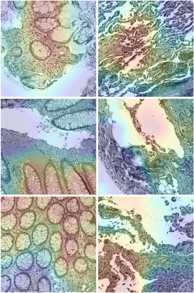 Figure 4 for Convolutional Neural Networks for Histopathology Image Classification: Training vs. Using Pre-Trained Networks