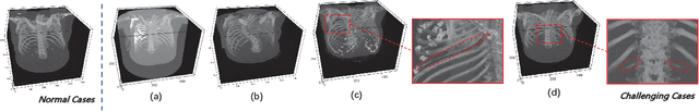Figure 2 for RibSeg v2: A Large-scale Benchmark for Rib Labeling and Anatomical Centerline Extraction