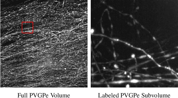Figure 1 for Self-Supervised Feature Extraction for 3D Axon Segmentation