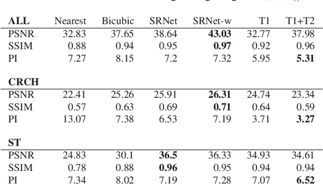 Figure 2 for Learning a Deep Convolution Network with Turing Test Adversaries for Microscopy Image Super Resolution