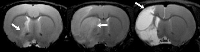 Figure 1 for Automatic Rodent Brain MRI Lesion Segmentation with Fully Convolutional Networks