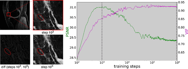 Figure 4 for Scale-Agnostic Super-Resolution in MRI using Feature-Based Coordinate Networks