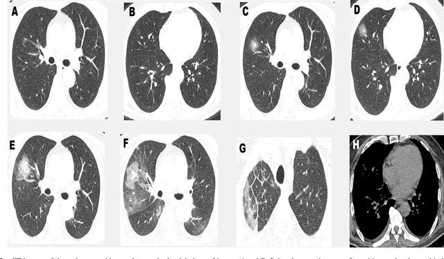 Figure 2 for A Novel AI-enabled Framework to Diagnose Coronavirus COVID 19 using Smartphone Embedded Sensors: Design Study