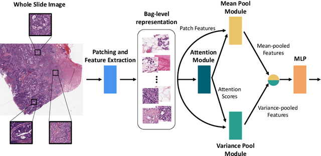 Figure 1 for Incorporating intratumoral heterogeneity into weakly-supervised deep learning models via variance pooling