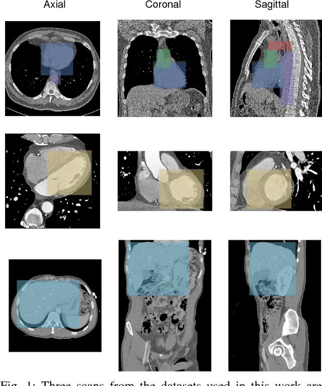 Figure 1 for ConvNet-Based Localization of Anatomical Structures in 3D Medical Images