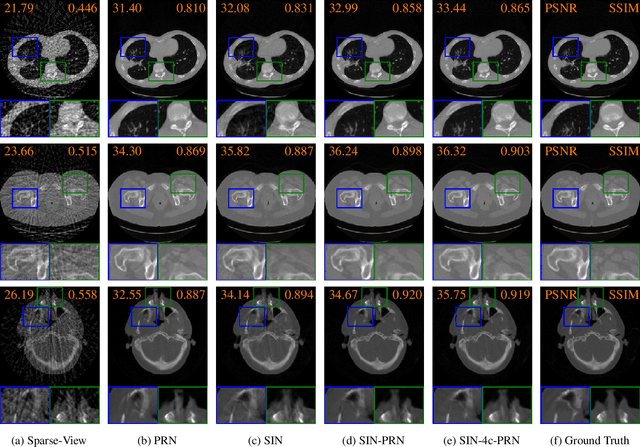Figure 3 for 2-Step Sparse-View CT Reconstruction with a Domain-Specific Perceptual Network