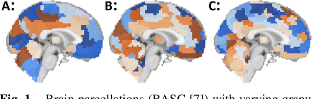 Figure 1 for Architectural configurations, atlas granularity and functional connectivity with diagnostic value in Autism Spectrum Disorder