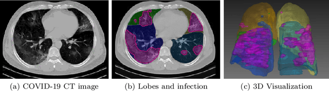 Figure 3 for Integrative Analysis for COVID-19 Patient Outcome Prediction