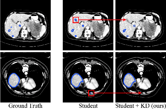 Figure 1 for Efficient Medical Image Segmentation Based on Knowledge Distillation