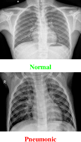Figure 1 for A Generalized Zero-Shot Quantization of Deep Convolutional Neural Networks via Learned Weights Statistics