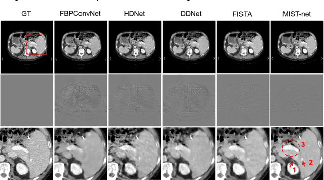 Figure 3 for Multi-domain Integrative Swin Transformer network for Sparse-View Tomographic Reconstruction