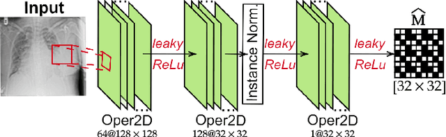Figure 4 for R2C-GAN: Restore-to-Classify GANs for Blind X-Ray Restoration and COVID-19 Classification
