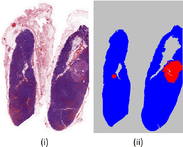 Figure 1 for Natural vs Balanced Distribution in Deep Learning on Whole Slide Images for Cancer Detection