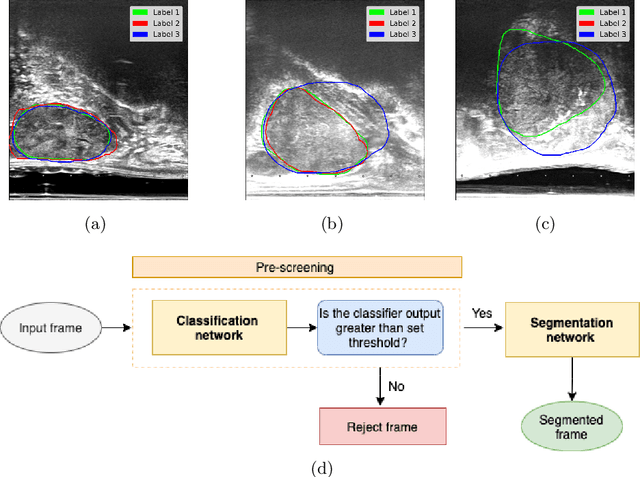 Figure 2 for Development and evaluation of intraoperative ultrasound segmentation with negative image frames and multiple observer labels