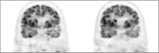 Figure 1 for Learning Personalized Representation for Inverse Problems in Medical Imaging Using Deep Neural Network