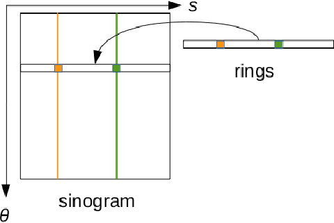 Figure 1 for Ring artifacts correction in compressed sensing tomographic reconstruction