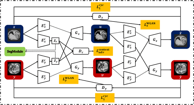 Figure 1 for Unsupervised Wasserstein Distance Guided Domain Adaptation for 3D Multi-Domain Liver Segmentation