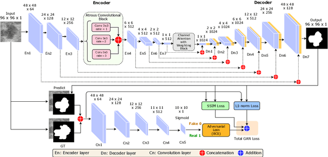 Figure 1 for An Efficient Solution for Breast Tumor Segmentation and Classification in Ultrasound Images Using Deep Adversarial Learning