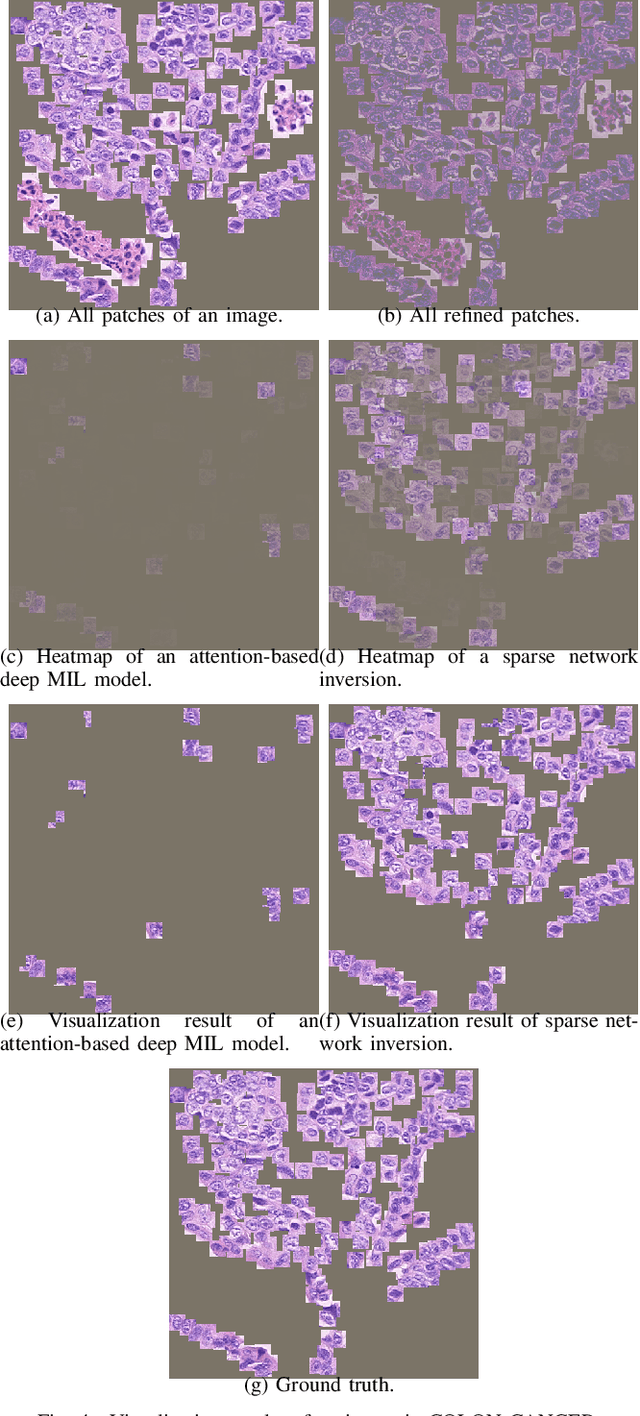 Figure 4 for Sparse Network Inversion for Key Instance Detection in Multiple Instance Learning