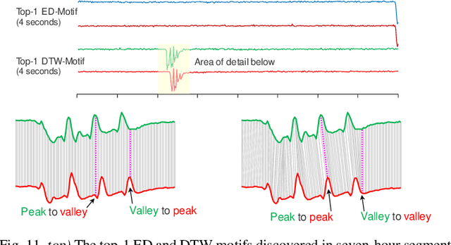 Figure 2 for Matrix Profile XXII: Exact Discovery of Time Series Motifs under DTW