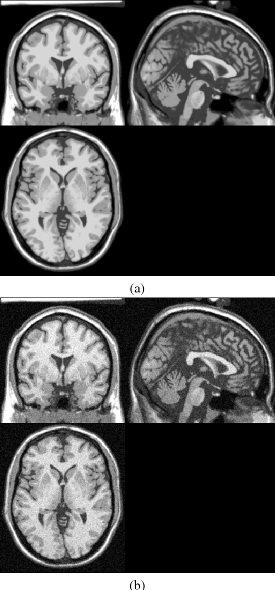 Figure 1 for Non-local Operational Anisotropic Diffusion Filter
