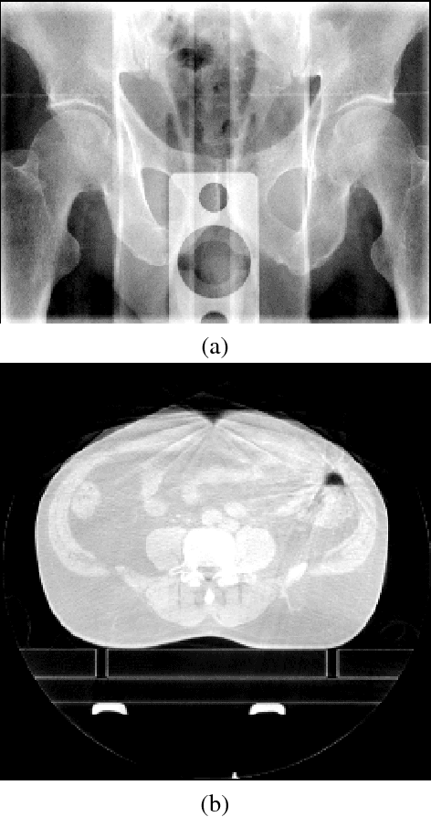 Figure 2 for Non-local Operational Anisotropic Diffusion Filter