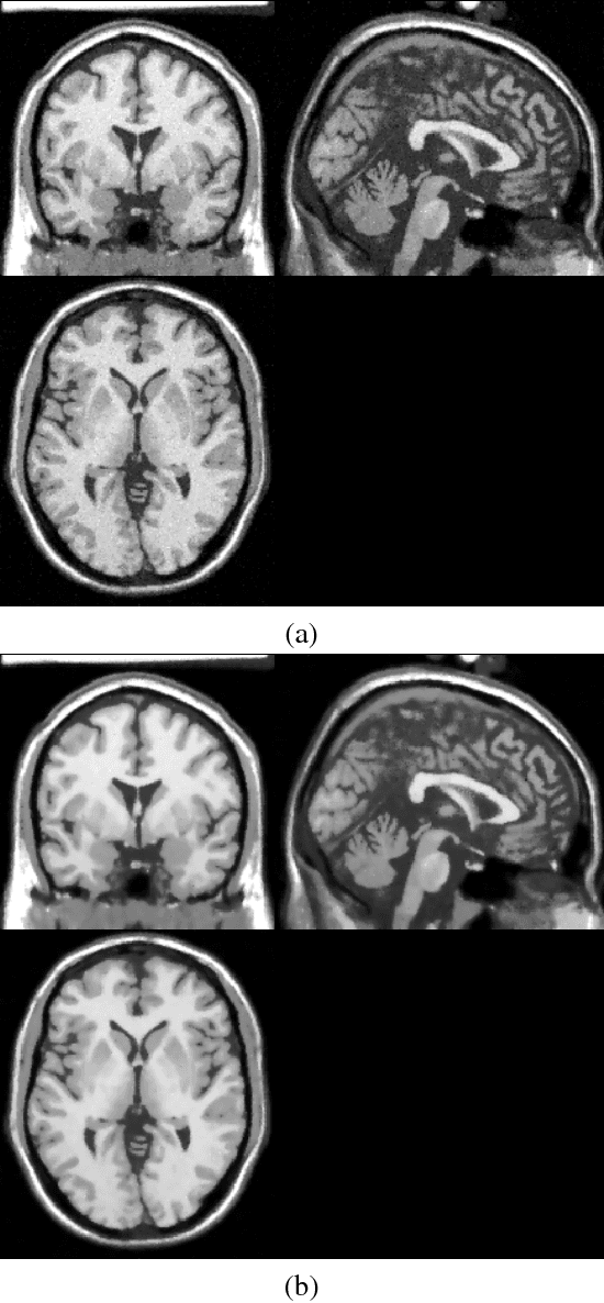 Figure 3 for Non-local Operational Anisotropic Diffusion Filter