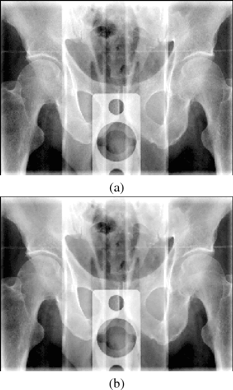 Figure 4 for Non-local Operational Anisotropic Diffusion Filter