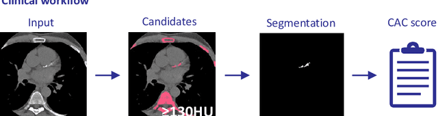 Figure 2 for AI for Calcium Scoring