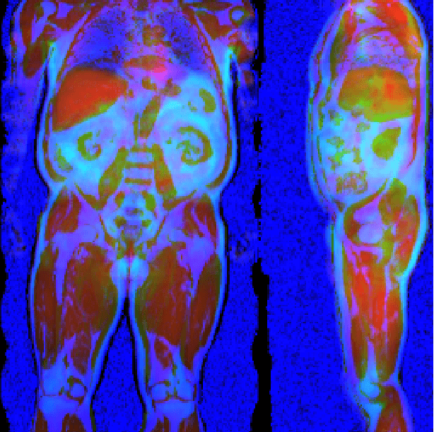 Figure 1 for Deep regression for uncertainty-aware and interpretable analysis of large-scale body MRI