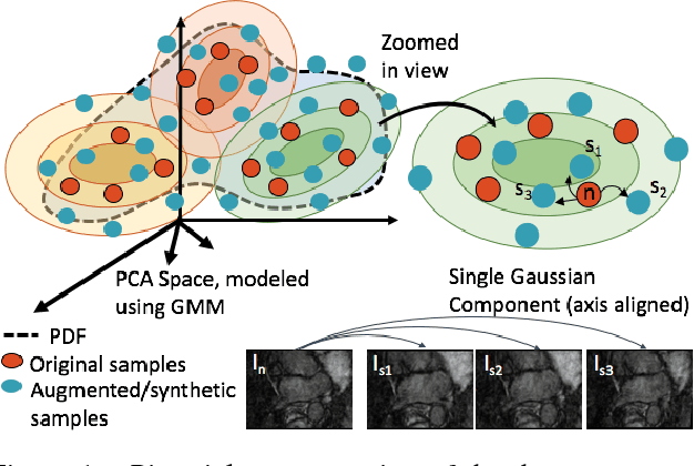Figure 1 for Deep Learning for End-to-End Atrial Fibrillation Recurrence Estimation