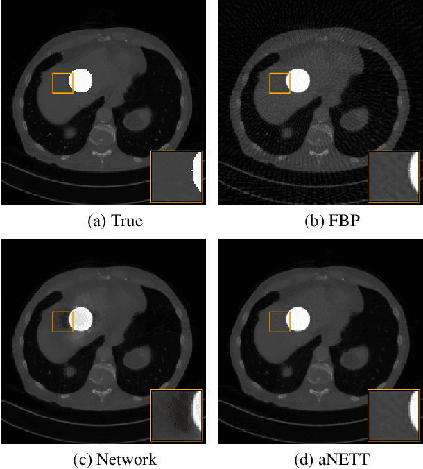 Figure 4 for Sparse aNETT for Solving Inverse Problems with Deep Learning