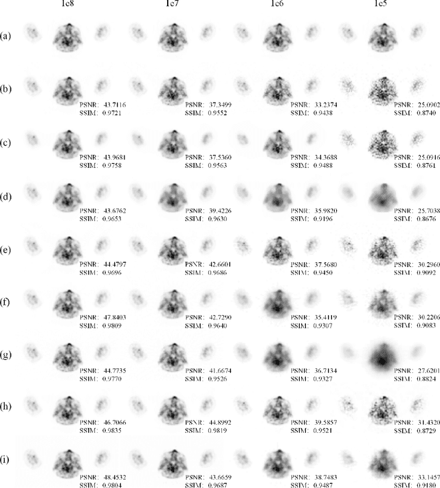 Figure 2 for Unsupervised PET Reconstruction from a Bayesian Perspective