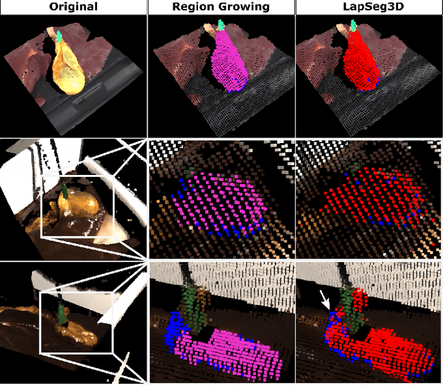 Figure 4 for LapSeg3D: Weakly Supervised Semantic Segmentation of Point Clouds Representing Laparoscopic Scenes