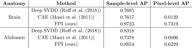 Figure 2 for Detecting Outliers with Foreign Patch Interpolation