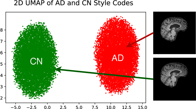 Figure 3 for Structure Guided Manifolds for Discovery of Disease Characteristics