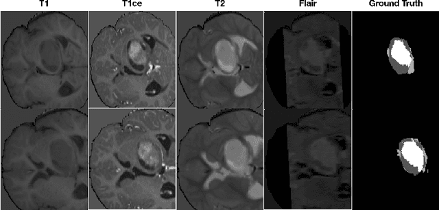 Figure 3 for Automatic Data Augmentation for 3D Medical Image Segmentation